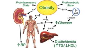 Pre-diabetes and Diabetes Mellitus