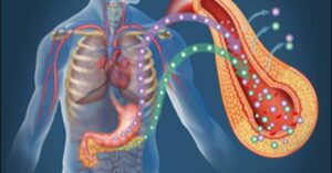 Metabolic Disorder